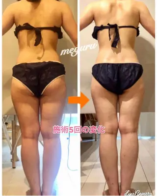 ショート カラー パーマ ヘアアレンジ メンズ キッズ ネイル マツエク・マツパ 痩身&ボディ 結果出し🌟丹野のエステ・リラクイメージ