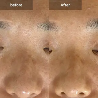 目元・まつパ・美肌フ ェイシャル谷町四丁目のマツエク・マツパデザイン