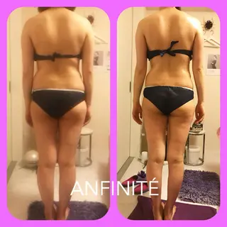 ANFINITÉ所属・ANFINITÉ アンフィニテのエステ・リラクイメージ
