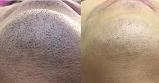 charmant (シャルマン)所属・エステサロン charmantのエステ・リラクイメージ