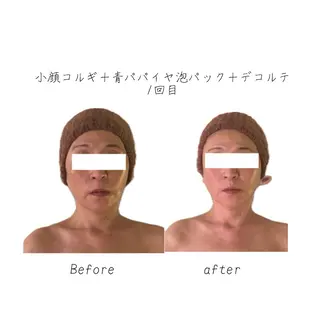 小顔コルギ専門店/隠れ家サロン《여름ヨルム》所属・小顔コルギ専門店 《ヨルム》龍ケ崎店のエステ・リラクイメージ