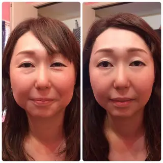 調律エステ /美KISSのその他イメージ