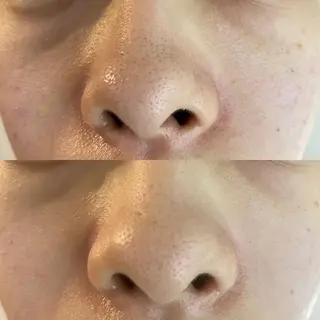 Meetite 小林のエステ・リラクイメージ