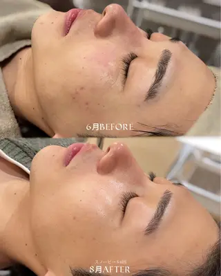 ファッショニスタ 中坪のエステ・リラクイメージ