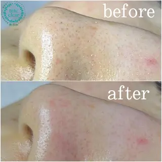 枝廣 貴子のエステ・リラクイメージ