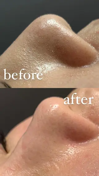 Lilyboo 池袋のエステ・リラクイメージ