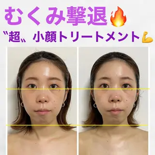 小顔・健康美専門店 Coputa所属・こりとり＆小顔 コルギ　専門店のエステ・リラクイメージ