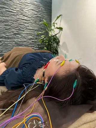 美容鍼灸整体サロンBeauJu所属・小顔矯/美容鍼/鍼灸 BeauJuのその他イメージ