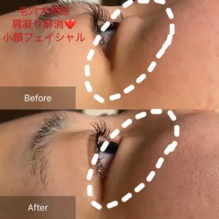 Mandarin Orange所属・毛穴から始める肌メン テマンダリンオレンジのエステ・リラクイメージ