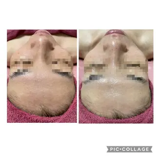 伊藤 順子のエステ・リラクイメージ