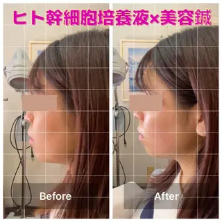 gomi sayakaのエステ・リラクイメージ