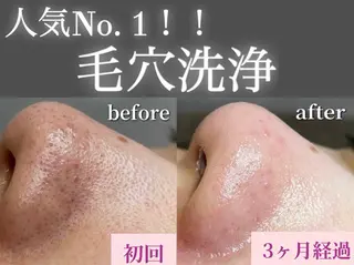 ココルアナ橋本店所属・ココルアナ 橋本店のエステ・リラクイメージ