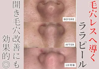 sii センター北 AIのエステ・リラクイメージ