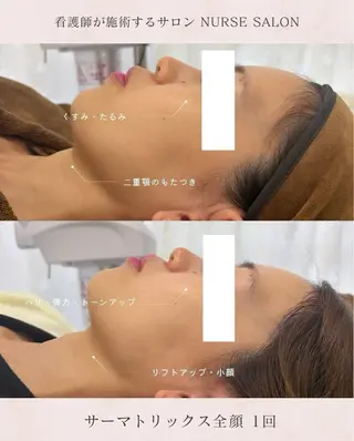 Ri naのエステ・リラクイメージ