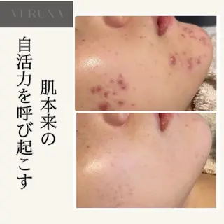 ニキビ改善専門店 d'Albaのエステ・リラクイメージ