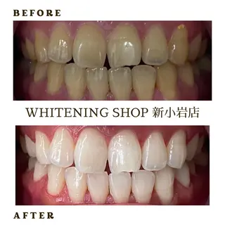 メンズ ホワイトニング ショップ新小岩店のその他イメージ