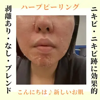 ピーリング専門店 Belluteのエステ・リラクイメージ