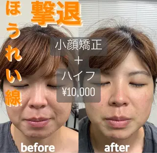 そノさき所属・大阪のシーサー🦁 島袋のエステ・リラクイメージ