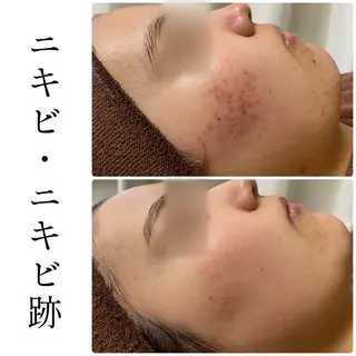 ハーブピーリング専門 BIOEL横浜のエステ・リラクイメージ
