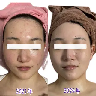 透明感の肌Lino malieのエステ・リラクイメージ