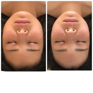 FLEUR大阪・美容 整体・痩身・小顔のエステ・リラクイメージ