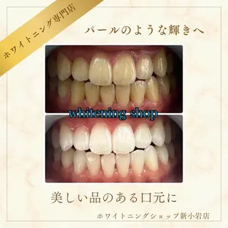メンズ ホワイトニング ショップ新小岩店のその他イメージ