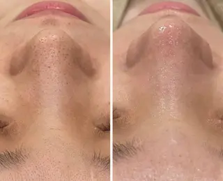 LiZA エステティックサロンのエステ・リラクイメージ