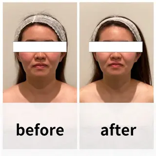 美容鍼/ヘッドスパ/ 💎さかもとのエステ・リラクイメージ