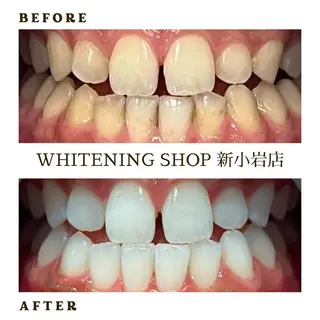 メンズ ホワイトニング ショップ新小岩店のその他イメージ