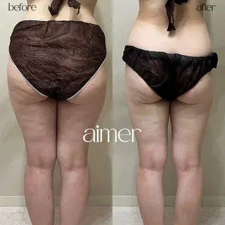 aimer所属・aimer 島田のエステ・リラクイメージ