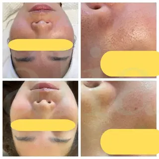 aliaハイフ&水光ジェットサロン所属・aliaハーブ水光店 エステティシャン募集のエステ・リラクイメージ