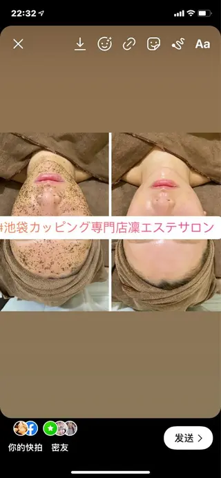 カッピング＆カッサ専門店凜所属・川嶋 凜のエステ・リラクイメージ