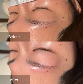 アイブロウ for woman所属・森 美優のエステ・リラクイメージ