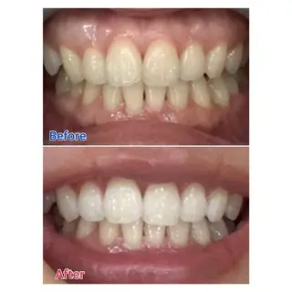 MBEAUTYSALON 千葉店・京成大久保所属・Melty 輝のその他イメージ