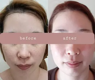 デ・アイム王寺所属・たるみ解消エミリーノ 米田真美子のエステ・リラクイメージ