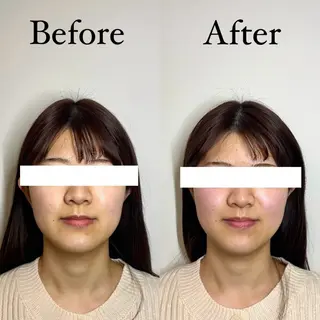 Hari Lounge恵比寿所属・chika🦋 ハリラウンジ恵比寿のエステ・リラクイメージ