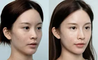 パーマ aliaハイフ&水光ジェットサロン所属・aliaハーブ水光店 エステティシャン募集のエステ・リラクイメージ