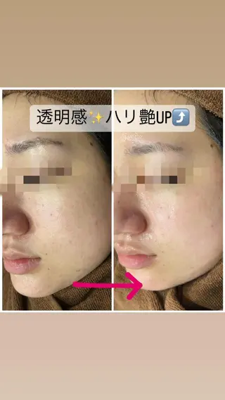 ショート カラー パーマ ヘアアレンジ メンズ キッズ ネイル マツエク・マツパ アイブロウ Amaryllis 🌹松本のエステ・リラクイメージ