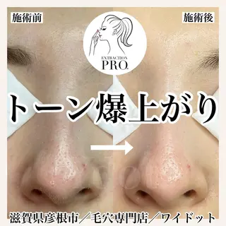 Ydot. 池内 友架のエステ・リラクイメージ