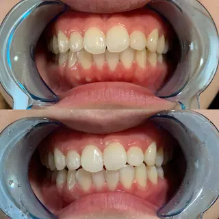 藤本 真心のネイルデザイン