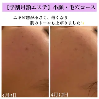 Bellesthe (ベルエステ)のエステ・リラクイメージ