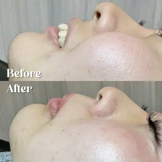 Hit. シュガーリング豊橋のエステ・リラクイメージ