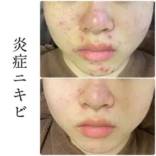 ハーブピーリング専門 BIOEL横浜のエステ・リラクイメージ