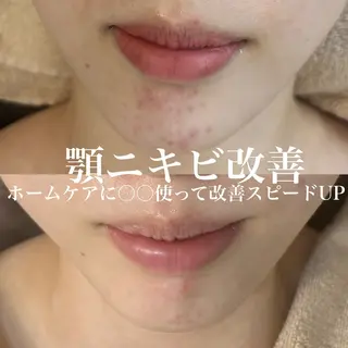 WHITE AQUA 北千住店のエステ・リラクイメージ