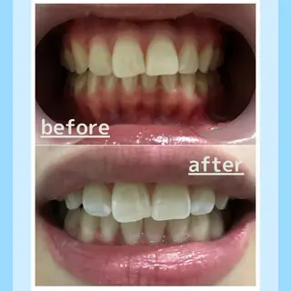 メンズ お手軽ホワイトニングsalon mina所属・武元 奈津美のその他イメージ