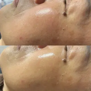 Lilyboo 池袋のエステ・リラクイメージ