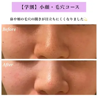 Bellesthe (ベルエステ)のエステ・リラクイメージ