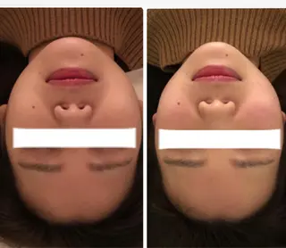 FLEUR大阪・美容 整体・痩身・小顔のエステ・リラクイメージ