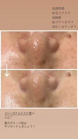 デアイム高島平所属・兼松 美香のエステ・リラクイメージ