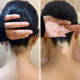 うなじ脱毛/美肌脱毛 LABELのエステ・リラクイメージ